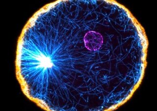 embryon oursin Jérémy Sallé