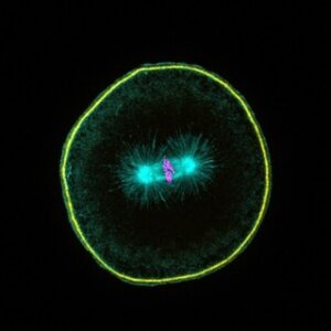 ImageJ=1.54f
unit=micron