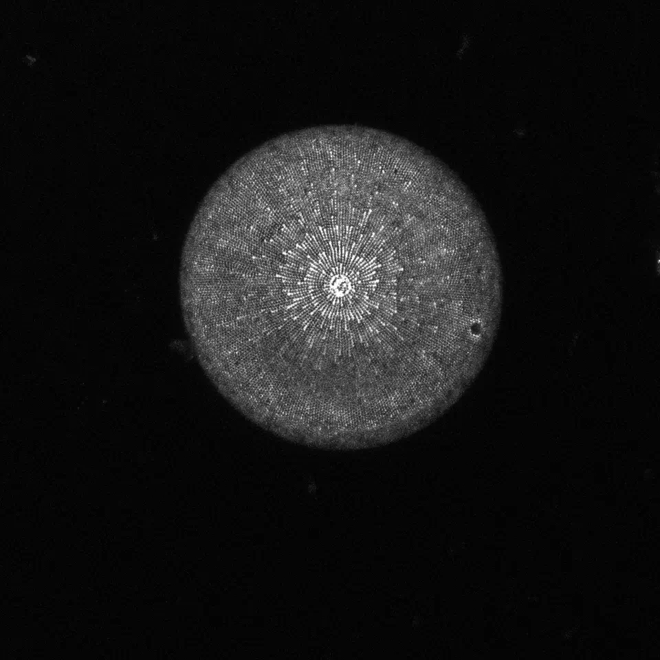 image de diatome en microscopie de fluorescence